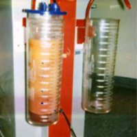 Liposculpture 006