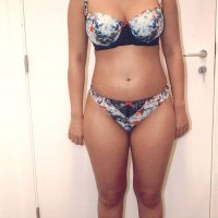 Liposculpture 011
