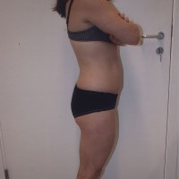 Liposculpture 007