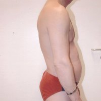 Liposculpture 010